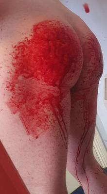 Extreme Selbstbestrafung