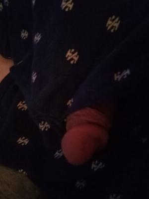 My hubby needs his tiny weewee removed, how do I do it