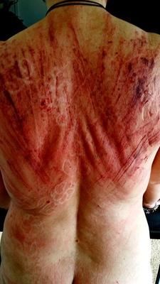 熟女のための極端なバックむち打ち