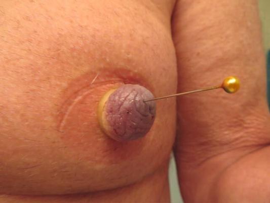 Needles and Pins