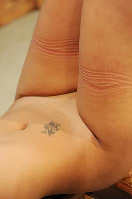 rope marks 